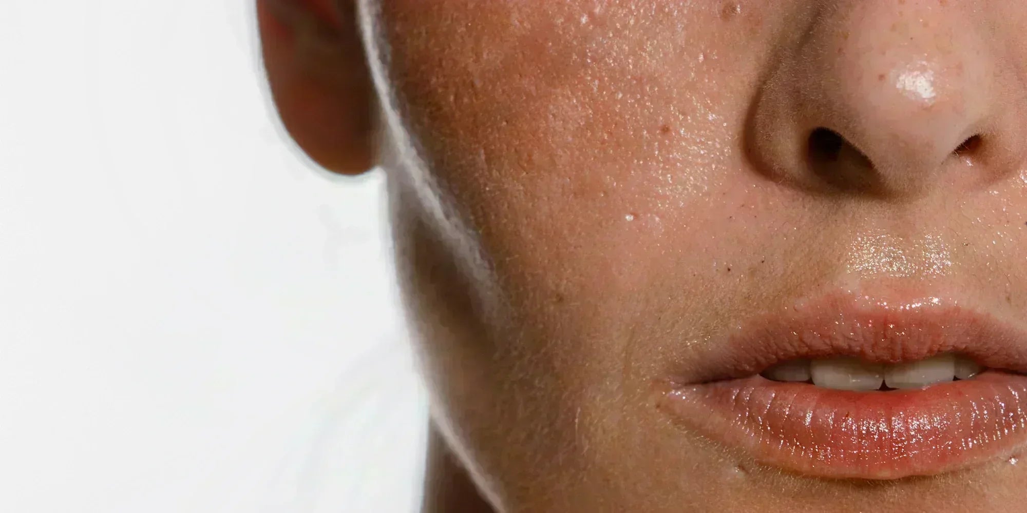 Comment estomper les taches pigmentaires : solutions naturelles et complémentaires efficaces - Ysalie Beauté