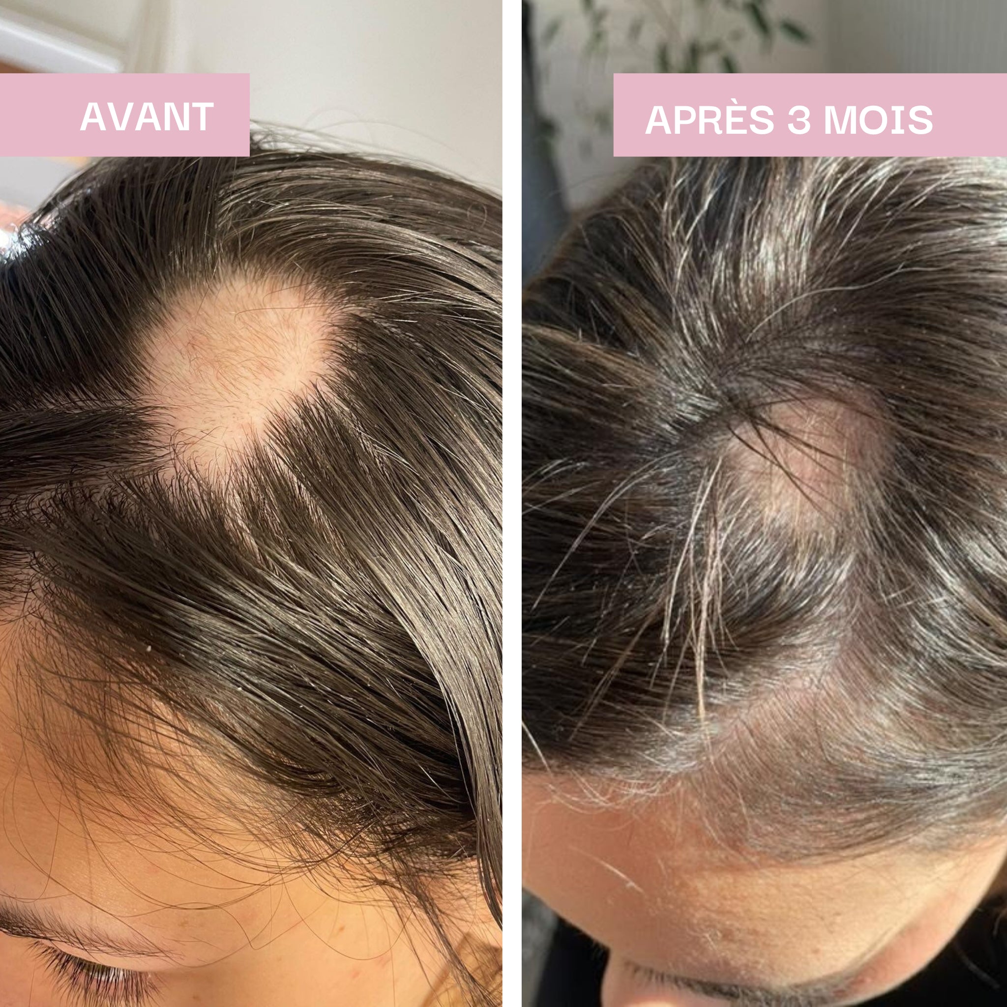 Diminution de la chute des cheveux, force & Longueur : Cheveux & Ongles Expert