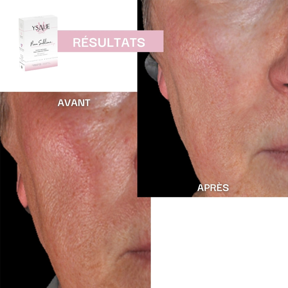 Peau Sublime - Hydratation et Éclat