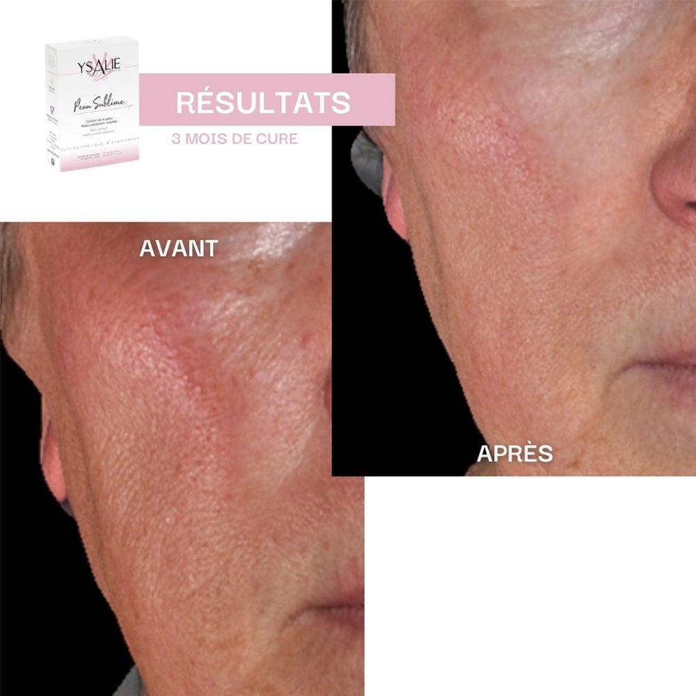 Peau Sublime - Hydratation et Éclat - complément alimentaire beauté | Ysalie Beauté