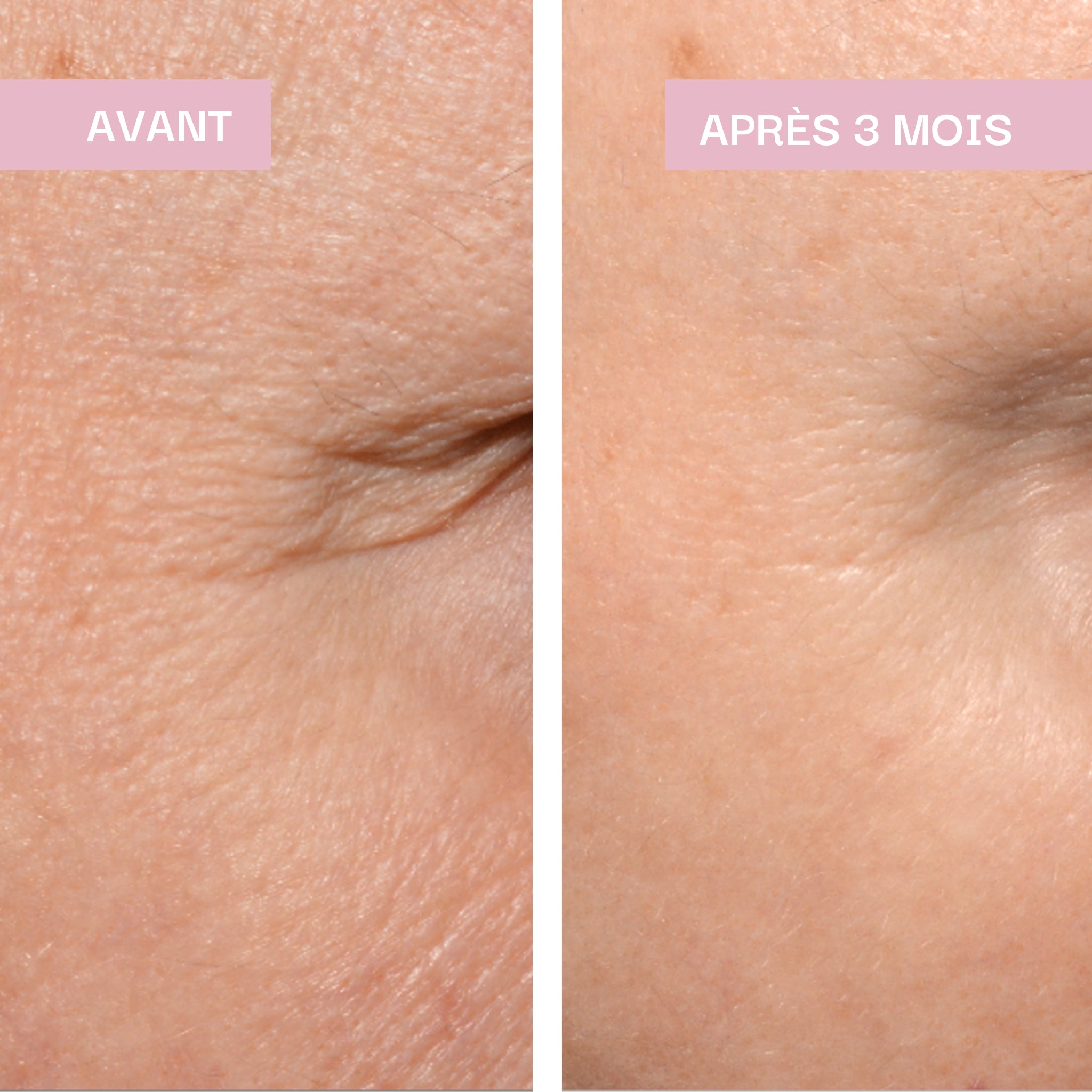 Hydratation & Éclat : Peau Sublime / Lipowheat® 350 mg