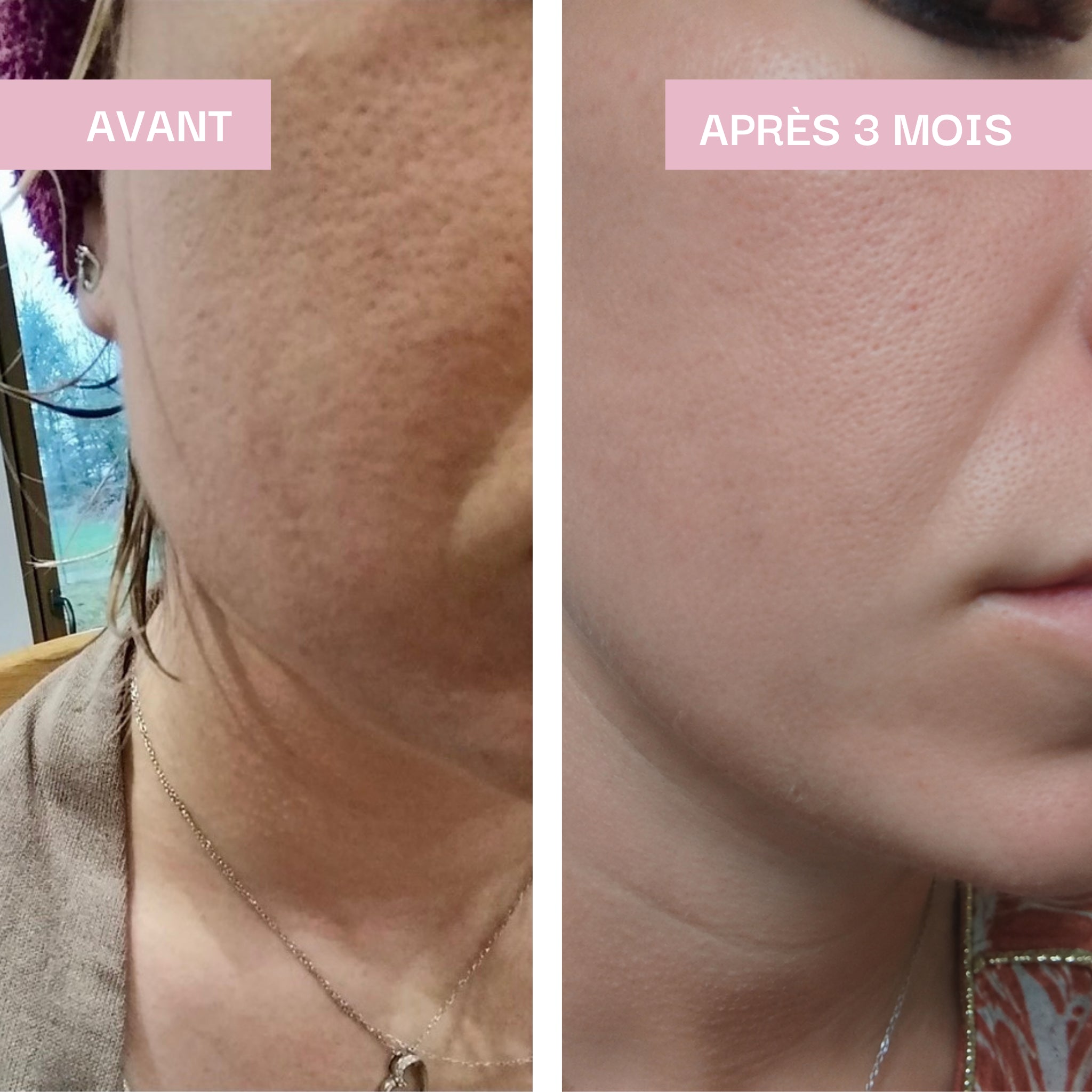 Hydratation & Éclat : Peau Sublime / Lipowheat® 350 mg