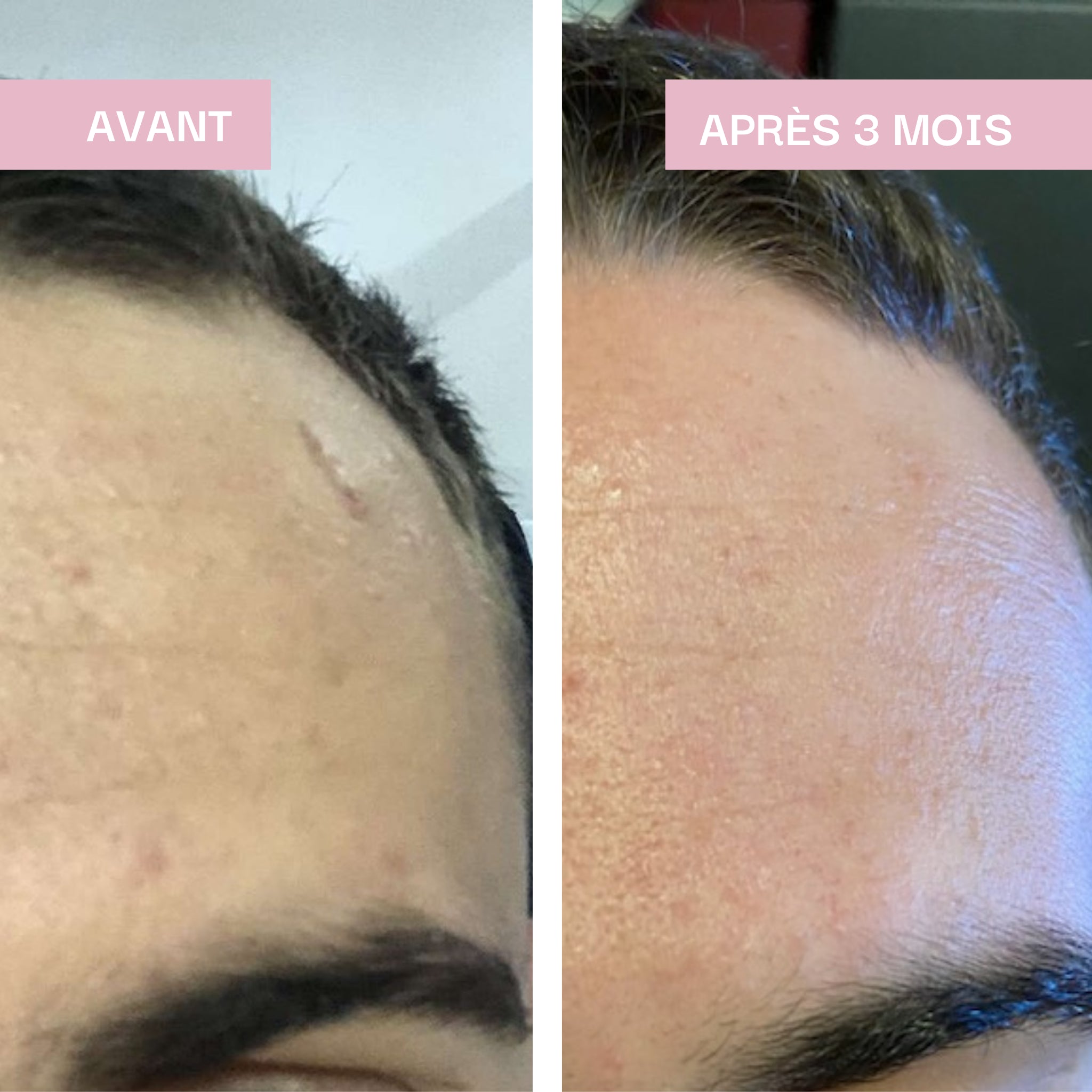 Hydratation & Éclat : Peau Sublime / Lipowheat® 350 mg