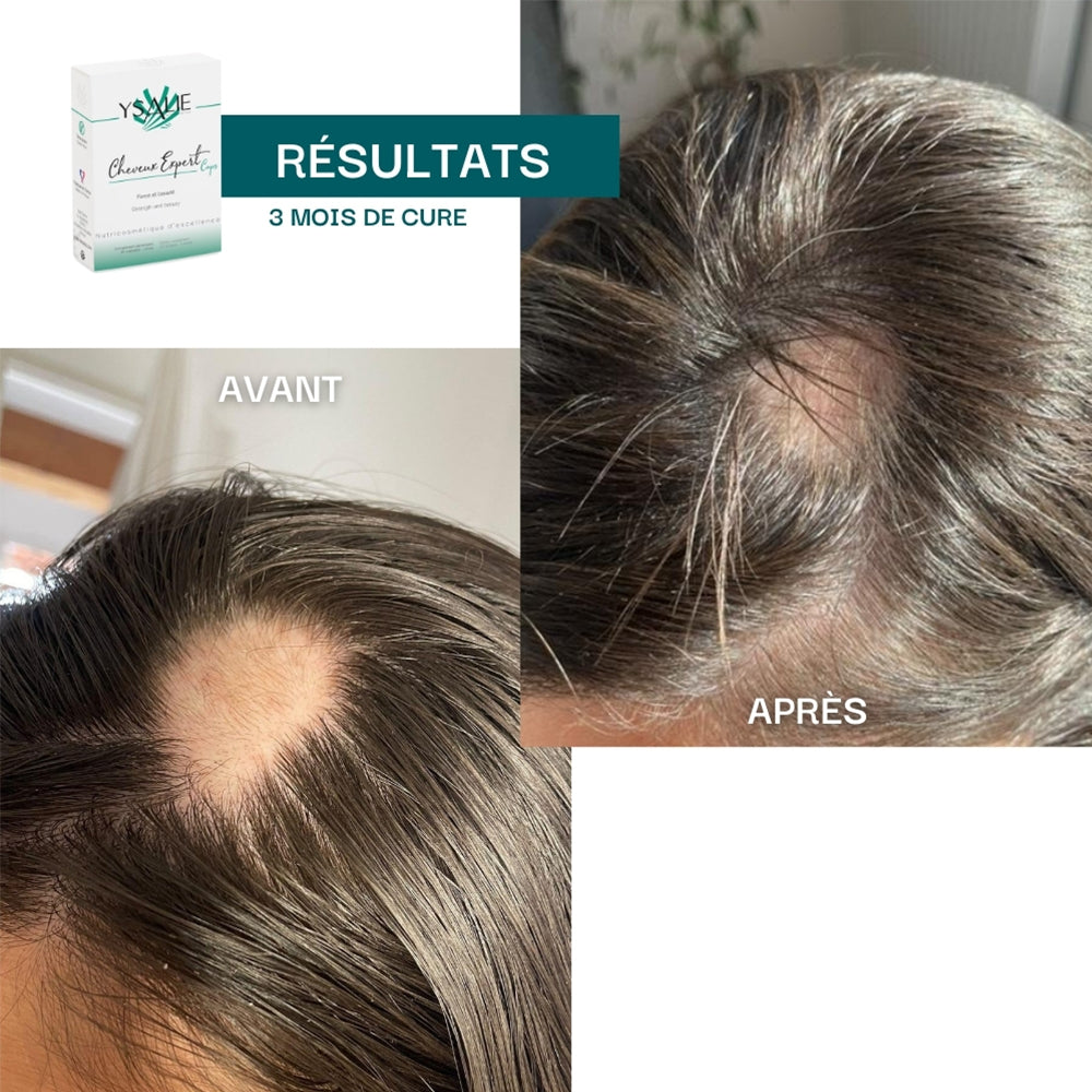 Cheveux et Ongles Expert - Force et Longueur