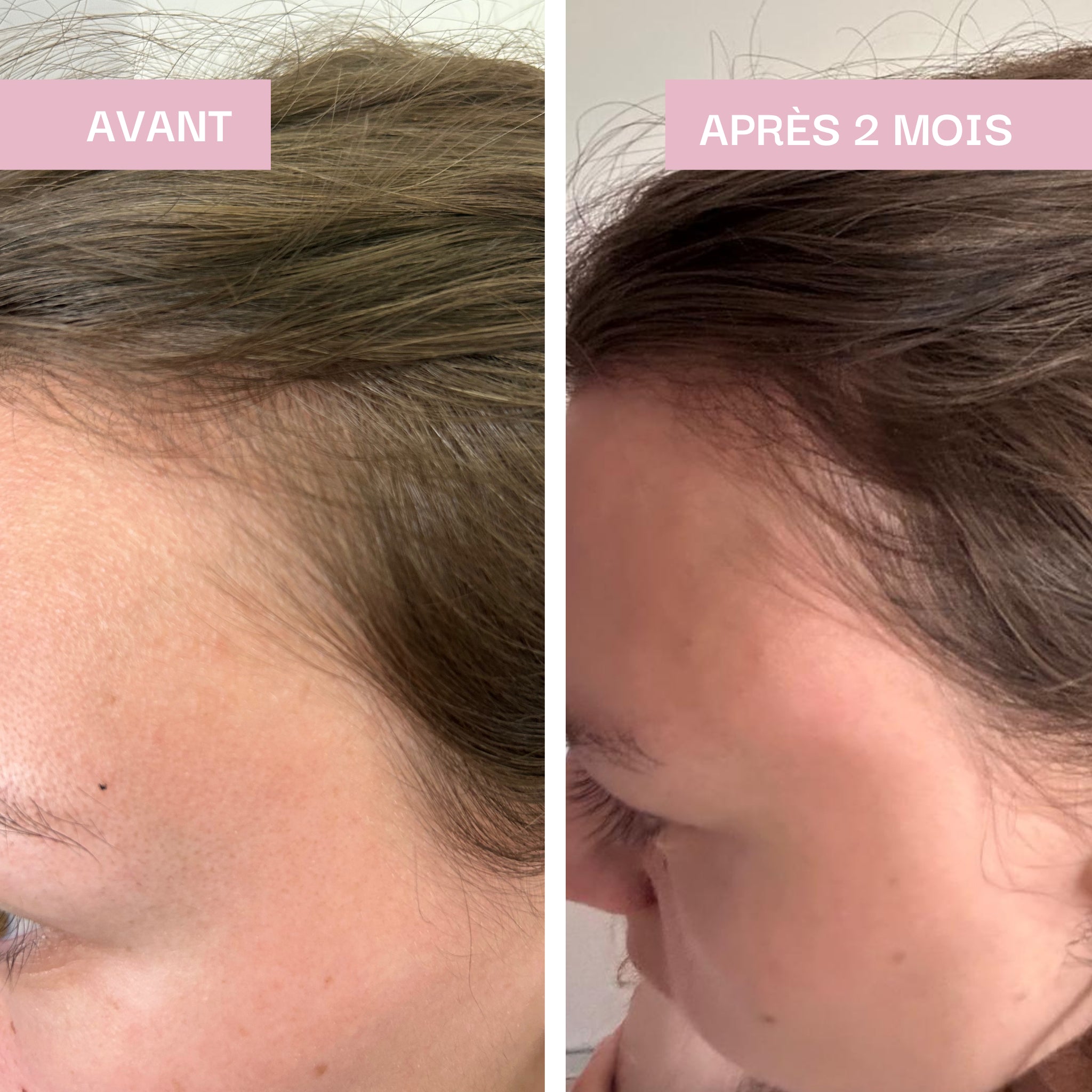 Diminution de la chute des cheveux, force & Longueur : Cheveux & Ongles Expert