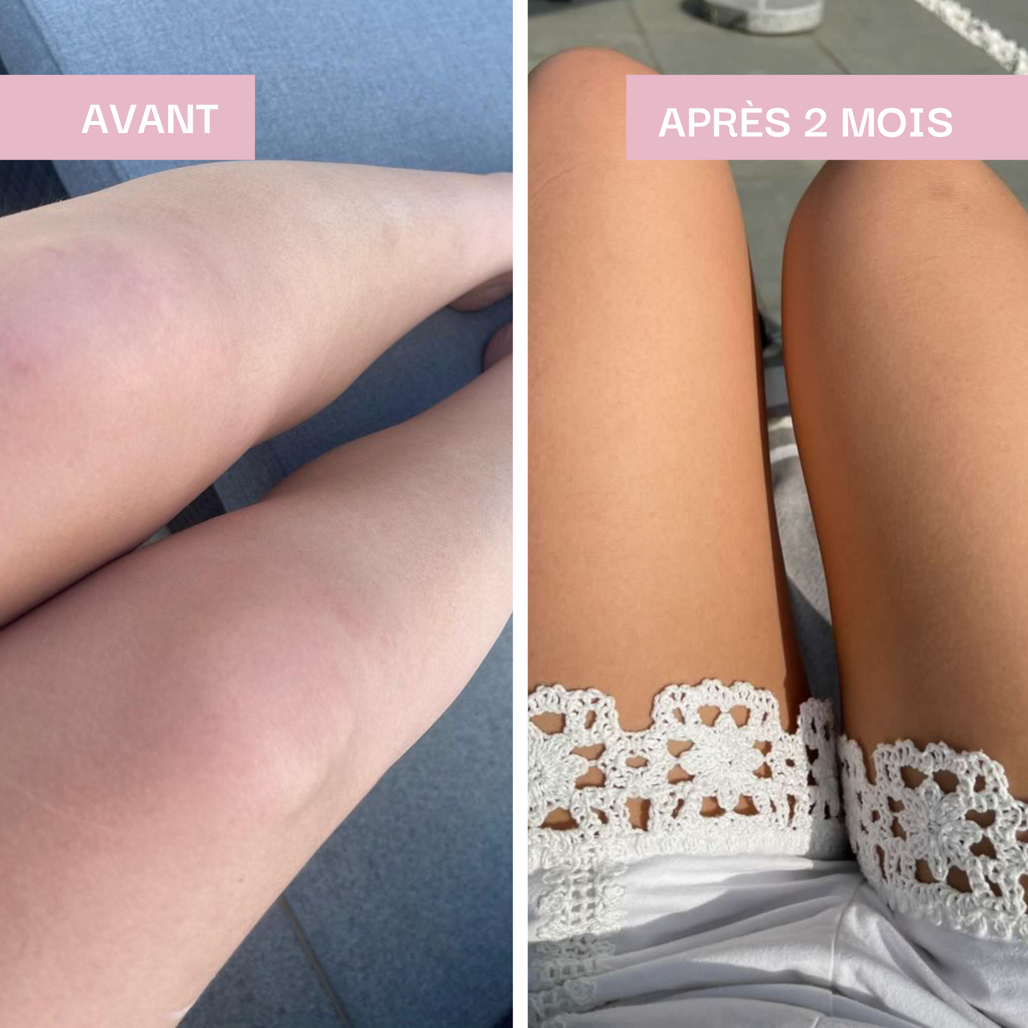 Préparation & Activation du bronzage : Idéal Soleil