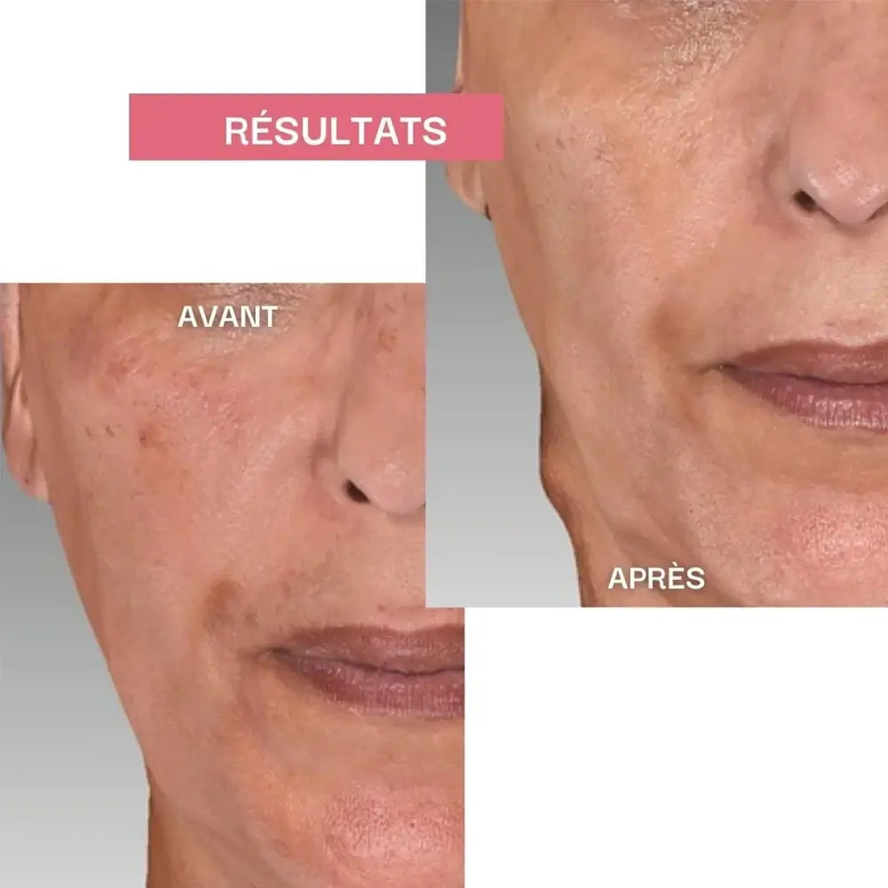 Teint Parfait - Éclat et Uniformité - complément alimentaire beauté | Ysalie Beauté